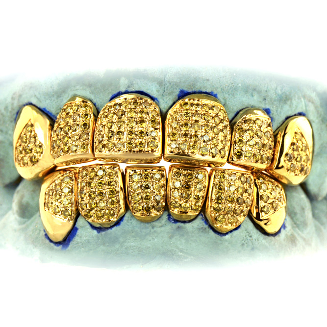 Gold Grillz Miami